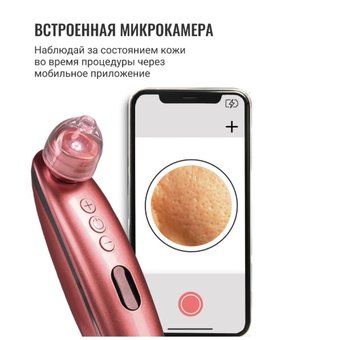  Прибор для лица GESS GESS-145 
