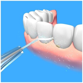  Ирригатор Jetpik JP50 Star 